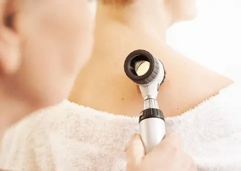 Anyajegy vizsgálata dermatoszkóppal